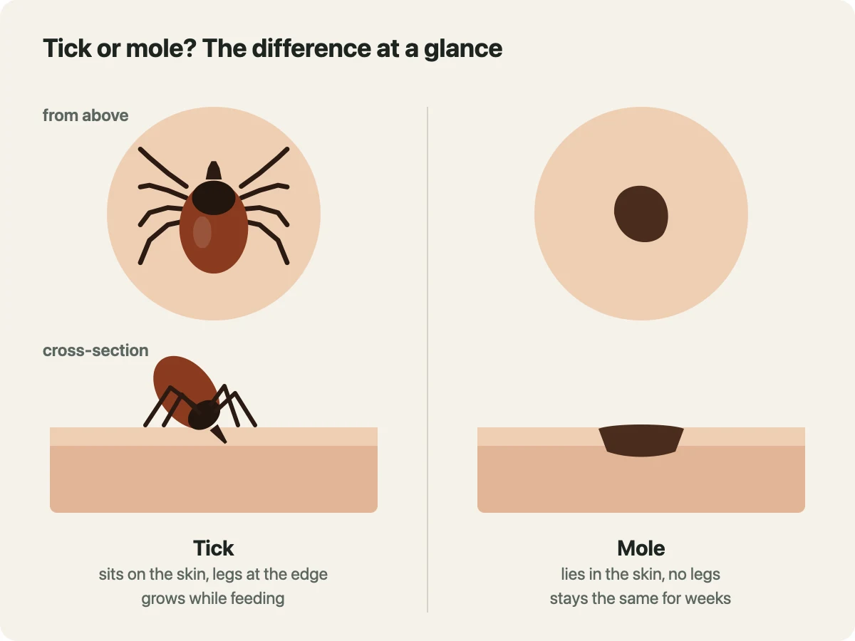 Comparison drawing from above and in cross-section through the skin: the tick sits raised and tilted on the skin, with legs at the edge and mouthparts in the skin; the mole lies flat in the skin and has no legs